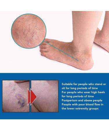 Varicose Vein Treatment Spray & Serum - 2 x 20ml for Spider Veins Relief | Effective Vein Care Cream - Buy Online on SooperMarket.com