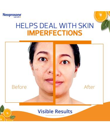 NEOPROSONE Vit C Dark Spot Corrector Gel Cream - Brightening Anti-Aging Solution for Face & Body - 60 ml / 2 fl oz - Remove Dark Spots & Even Skin Tone - Buy Online on SooperMarket.com