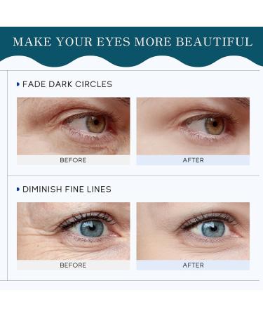 Eye Cream For Dark Circles And Puffy Eyes Eye Cream Anti Aging Caffeine Eye Cream Remove Fade Fine Line Hydrolyzed Collagen Hydrating Eye Cream Korean Eye Cream For Men & Women - Buy Online on SooperMarket.com