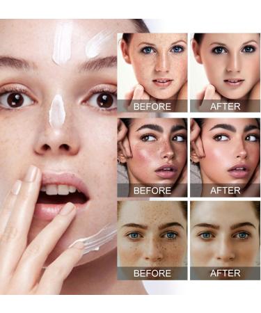 Fade Stain Beauty Cream Freckle Remover Cream Dark Spot Remover for Face Age Spot Remover Corrector Cream for Face and Body Dark Spot Remover Dark Spot Remover for Face and Body - Buy Online on SooperMarket.com