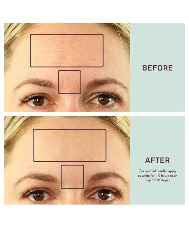Dermaclara Silicone Forehead Wrinkle Patch | Anti-Wrinkle Treatment for Fine Lines | Reusable & Pregnancy Safe | Shop Internationally - Buy Online on SooperMarket.com