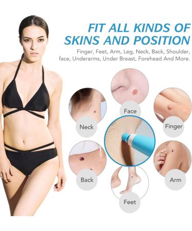 Skin Tag Remover Kit with Auto Pen, 40 Bands - Painless Device for Small to Large Warts (2mm-8mm) - Buy Online on SooperMarket.com