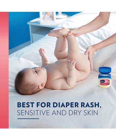 Buy Vaseline Baby Petroleum Jelly 13 oz - Gentle Moisturizer for Babies | International Shipping Available - Buy Online on SooperMarket.com