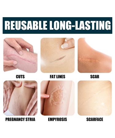 Scar Cream for Smooth Skin Repair - Non-Greasy Gel for Stretch Marks, Wrinkles, Old & New Scars - Buy Online on SooperMarket.com
