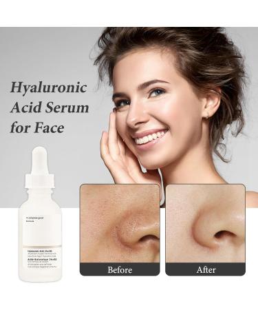 Hyaluronic Acid 2% + B5 30ML Hyaluronic Acid Serum for Face Dark Spot Remover for Face Hyaluronic Acid Face Moisturize Skincare Serum for Face to Plump and Smooth Skin for All Skin Types Skin Care - Buy Online on SooperMarket.com
