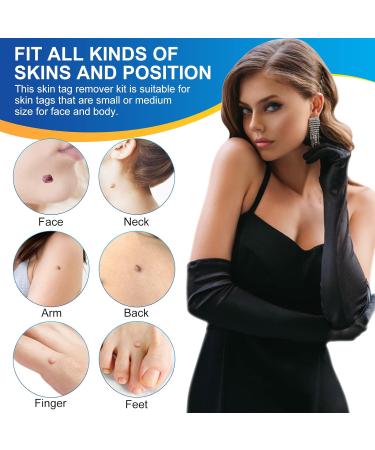 Skin Tag Remover Kit - Painless 2-in-1 Device for Medium to Large Skin Tags (2mm-7mm) - Mole Wart Removal Tool for Women and Men - Buy Online on SooperMarket.com