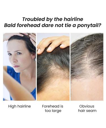 Hair Growth Oil | Jojoba & Wild Oil - Natural Anti-Frizz Density Boost for Men & Women - 30 ml | Aznever - Buy Online on SooperMarket.com