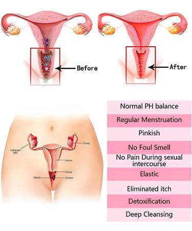 Anniecare Natural Repair Vaginal Capsule | Instant Anti-Itch & Tighten | 4PCS - Buy Online on SooperMarket.com