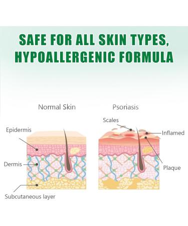 Neyeau Natural Organic Chinese Herbal Cream Skin Cream Soothing Ointment Dermatitis Cream - Relieve Itching for Dry Skin Rough Skin Peeling Moisturizing Skincare External Use - Buy Online on SooperMarket.com