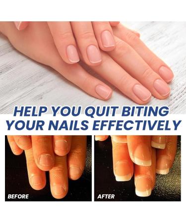 Anti Nail Biting Nail Polish Stop and Grow Nail Biting Stop Nail Biting Stop Biting Nails Nail Biting Prevention Nail Biter Stopper Nail Biting Treatment Clear Nail Varnish Safe Natural Plant Extract - Buy Online on SooperMarket.com