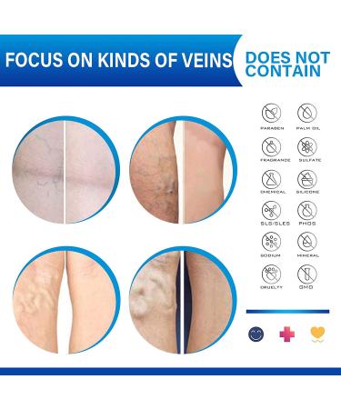 Varicose Veins Cream - Effective Treatment for Leg Relief, Phlebitis & Circulation Improvement (1.7 Fl Oz) - Buy Online on SooperMarket.com