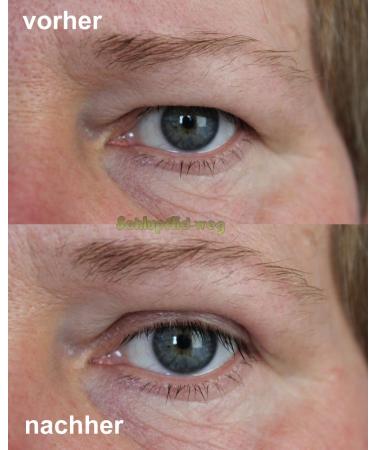Buy MAGIC Invisible Girl Size S - Eyelid Lifting Without Surgery (1x60 Pairs) | International Shipping Available - Buy Online on SooperMarket.com