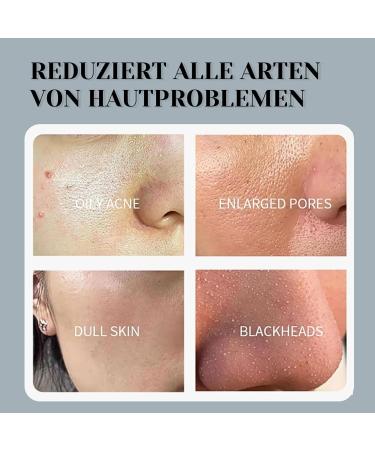Dead Sea Mask Deep Cleansing Face Mask Skin Care Improve Blackheads Acne Dark Spots Even Skin Tone Face Mask Control Oil Refining Pores (Dead Sea) - Buy Online on SooperMarket.com