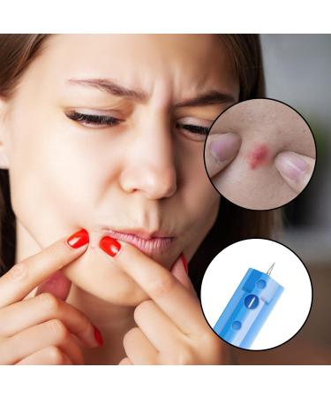 JNAWA 50 Pieces Blackhead Remover Tools Professional Pimple Popper Needle Remover Tools Blackhead Extractor Tool for Beauty Salon - Buy Online on SooperMarket.com
