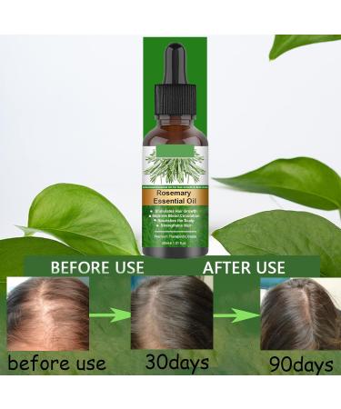 Rosemary Oil for Hair Growth 60ml Hair Oil Diminishes Signs of Aging Nourishes the Scalp Strengthens Hair Stimulates Hair Growth Treat Dry Damaged Hair Rosemary Essential Oil for Hair Growth 2 Brush 30ml - Buy Online on SooperMarket.com