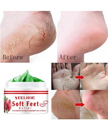 Intensive Regenerating Foot Cream - Ultimate Foot Care Balm for Dry Feet & Cracked Heels - 1g | Soothing Relief for All Skin Types - Buy Online on SooperMarket.com