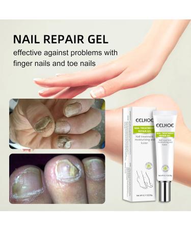 Yueci Hand and Foot Care Cream - Heal & Repair Damaged Nails | Nail Treatment for Cracked & Split Toes - Buy Online on SooperMarket.com