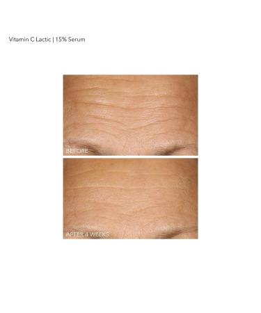 Dr. Dennis Gross Vitamin C Lactic 15% Firm & Brighten Serum 1 oz - Anti-Aging Solution - Buy Online on SooperMarket.com