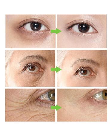 Green Tea Eye Cream - Reduce Dark Circles Puffiness & Wrinkles | Anti-Aging Daily Eye Care 15g - Buy Online on SooperMarket.com