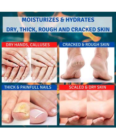 TIS UREA Cream 30% - Treat Eczema Psoriasis & Dry Skin | 2 x 50g | AHA & Wheat Germ Oil | Improve Wounds & Scars - Buy Online on SooperMarket.com