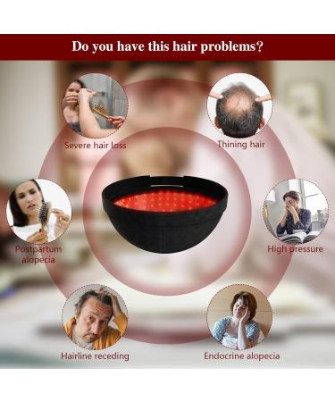 Jitesy Laser Therapy Cap - 236 Probes Red-Blue-Light Hair Growth System for Thinning Hair & Androgenetic Alopecia Treatment - Fast International Shipping - Buy Online on SooperMarket.com