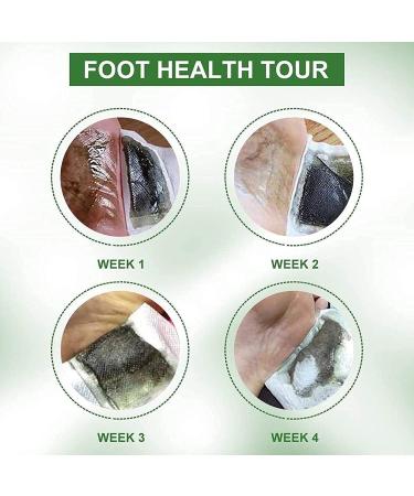 10PCS Detox Foot Pads Natural Slimming Patch Loss Weight Body Toxins Relief Stress Improve Sleep - Buy Online on SooperMarket.com