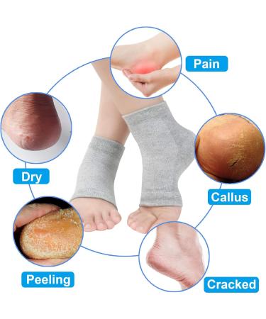 Vented Moisturizing Gel Heel Socks 3 Pairs Toeless Spa Sock for Foot Care Treatment Cracked Heels Dry Feet Foot Calluses (Black) - Buy Online on SooperMarket.com
