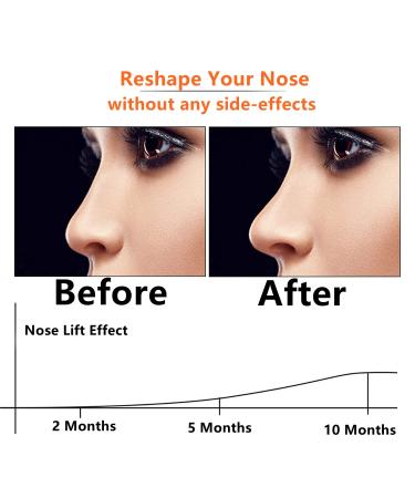 Nose Shaper Clip - Silicone Nose Lifter & Slimming Tool for Beautiful Straight Nose | Rhinoplasty Bridge Corrector for Women (Green - Buy Online on SooperMarket.com