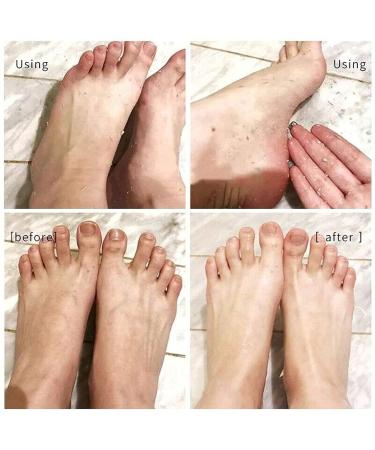Foot Peeling Spray with Orange Oil Exfoliate Dead Skin & Calluses Fast | Hydrating & Nourishing Formula - Buy Online on SooperMarket.com