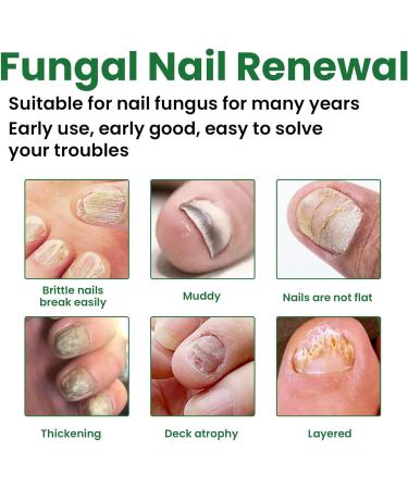 MrCuvaryas Nail Serum for Toenails Extra Strong - Buy Online on SooperMarket.com