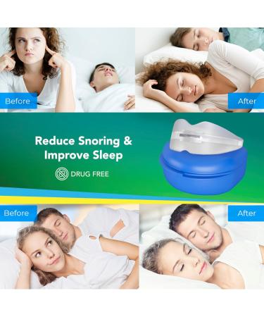 Anti Snoring Devices: Effective Snoring Solution - Snore Guard Anti-snoring Device - Snoring Mouth Guard - Anti Snore Mouthpiece for Stop Snoring (Green) - Buy Online on SooperMarket.com