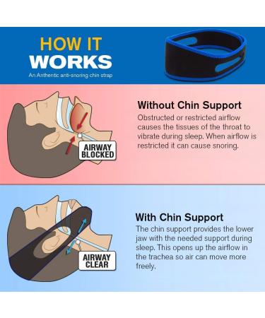 New Upgrade Anti Snoring Chin Strap for Men and Women - Adjustable, Effective Stop Snoring Aid for Better Sleep - Buy Online on SooperMarket.com