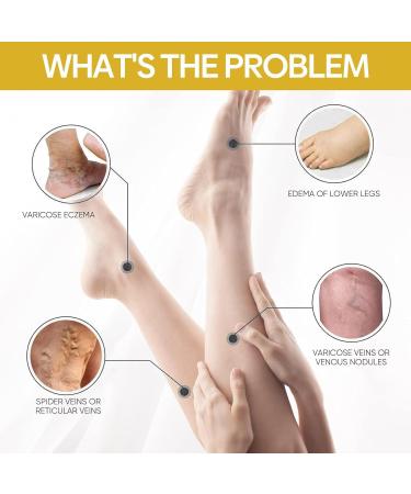Furzero Bienengift Varicose Veins Cream - Test Winner Spider Vein Relief | 5-Piece Beeergift Pain Cream for Everyone | International Shipping Available - Buy Online on SooperMarket.com