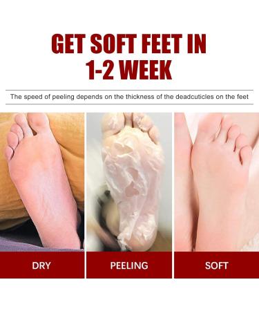 Bexdug Foot Peeling Mask - Exfoliating Peeling Socks for Soft Smooth Feet | Moisturizing Treatment & Dead Skin Remover | Heel Repair | 1 Piece - Buy Online on SooperMarket.com