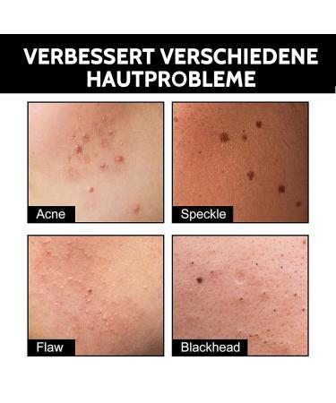 Shefave Pimple Patch 108pcs - Cute Black Acne Patches for Day & Night Care | Hydrocolloid Facial Treatment for Fast Pimple Relief - Buy Online on SooperMarket.com