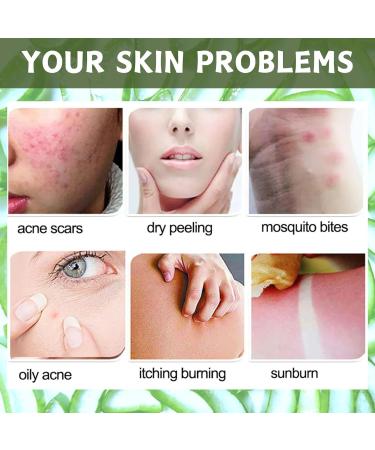 Aloe Vera Exfoliating Scrub Cleanser Aloe Vera Gel Face Wash Natural Acne Face Wash Face Wash For Men & Women Cream Cleanser For Acne Prone & Oily Skin Face Wash - Soothe Purify Facial Skin Care Green-Aloe Vera - Buy Online on SooperMarket.com