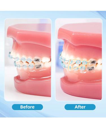 500pc Annhua Dental Orthodontic Rubber Bands | Teeth Gap & Crooked Teeth Braces | Monkey 4.5oz 3/8 - Buy Online on SooperMarket.com