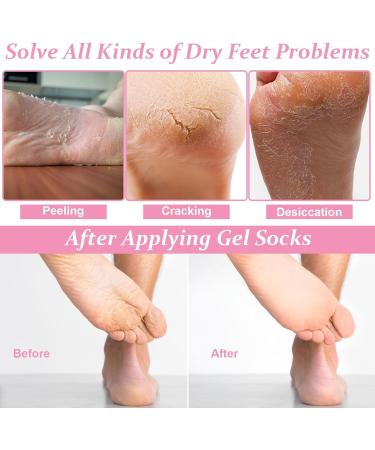 Zuroki Gel Socks - Moisturizing Spa Foot Care for Soft Feet | Reusable Cornea Socks | Ideal Gift for Women | 2 Pairs - Buy Online on SooperMarket.com