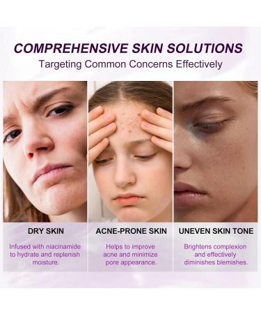 Marianp Hyaluronic Acid Serum & Azelaic Acid 10% for Acne Pigmentation & Rosacea - Vitamin B3 & B5 | Best Skincare Treatment - Buy Online on SooperMarket.com