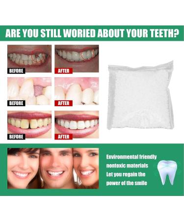 Temporary Teeth Repair Kit - Moldable Thermal False Teeth Fitting Beads - 50g - Buy Online on SooperMarket.com