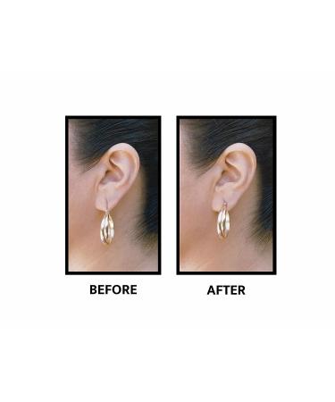 Lobe Wonder Ear Lobe Support Patch - Prevents Torn Piercings - 480 Clear & Latex-Free Patches - Buy Online on SooperMarket.com