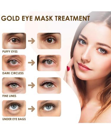 24K Gold Under Eye Patches - Reduce Dark Circles & Puffiness | Hydrating Eye Masks for Wrinkles - 30 Pairs (60 Count - Buy Online on SooperMarket.com