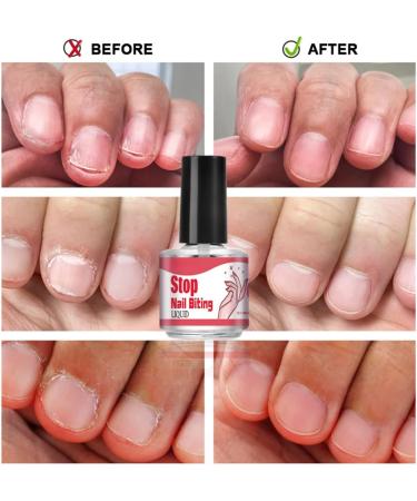 Anti Nail Biting Nail Polish Quick Drying Nail Biting Prevention No Bite Nail Polish Stop Biting Nail Nail Biting Prevention for Adults Clear Anti Nail Biting Polish Stop Nail Biting Nail Varnish - Buy Online on SooperMarket.com