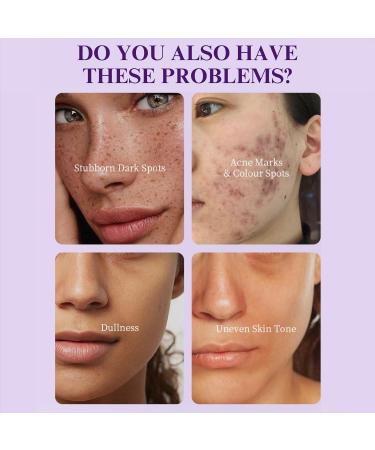 Dark Spot Corrector Serum Niacinamide Serum Brightening Serum Niacinamide+ 5% Tranexamic Acid Hydrating Serum Dark Spot Corrector For Face Age Spot Remover For Face Face Redness Remover - Buy Online on SooperMarket.com