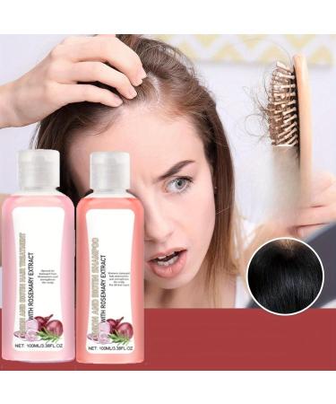 Onion Biotin & Rosemary Shampoo Set | Natural Hair Care for Dry Frizzy Hair - Hair Growth Serum with Moroccan Oil - Buy Online on SooperMarket.com