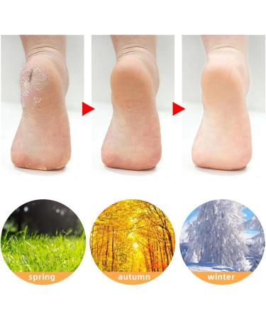 3 Pairs Silicone Moisturizing Socks Flexible Elastic Hydrating Spa Socks Pedicure Socks for Dry Cracked Feet Pink Skin Tone White (-1411240283012) - Buy Online on SooperMarket.com