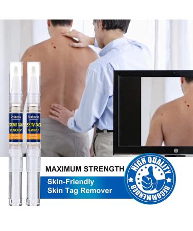 Extra Strength Skin Tag Remover | Wart Removal | Tag Dries and Falls Away | Natural Ingredients | All Skin Types - Buy Online on SooperMarket.com