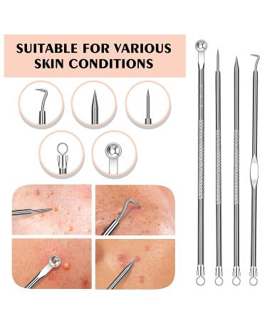 AUSLKA Zebra Blackhead Pore Strips (60 ct) + Remover Extractor Kit - Deep Cleansing Charcoal Strips for Acne Removal - Buy Online on SooperMarket.com