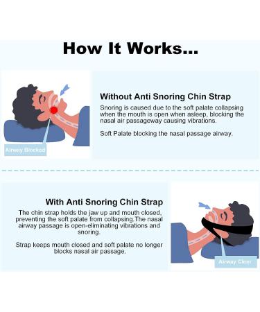 Anti-Snoring Chin Strap for CPAP Users - Effective Solution for Men and Women to Reduce Snoring and Achieve Peaceful Sleep - Buy Online on SooperMarket.com