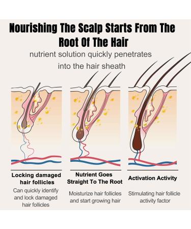 GoldWorld Rosemary Oil for Hair Growth w/Derma Roller Hair Growth Men Women 100ml Light-Weight Non-Greasy Hair Growth Oil Serum Reduce Beard Hair Loss Diluted Rosemary Oil Dry Damaged Hair Tonic - Buy Online on SooperMarket.com